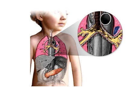5 de setembro – Dia Nacional de Conscientização e Divulgação da Fibrose Cística