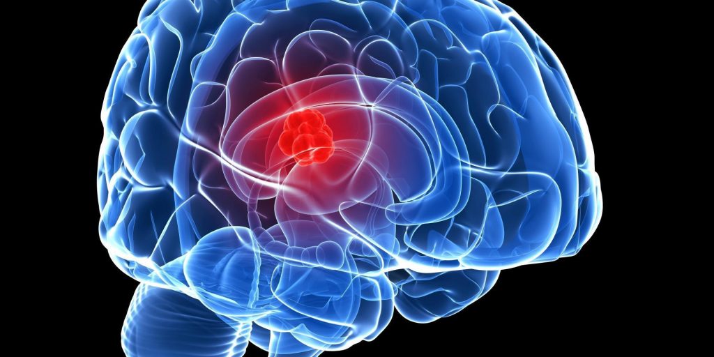 Zika vírus poderia ajudar a combater o câncer cerebral, diz estudo!