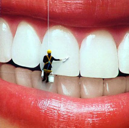 Mas, afinal, o que é cárie dentária?