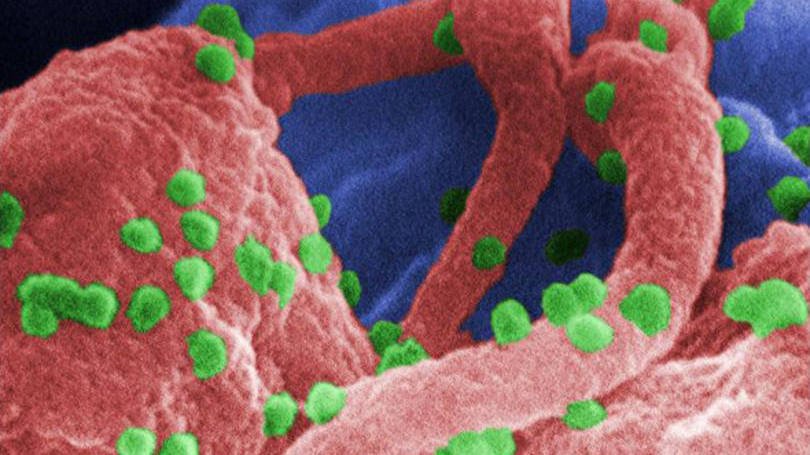 Cura para o HIV – Cientistas britânicos podem ter encontrado? | Exame.com, BBC Brasil
