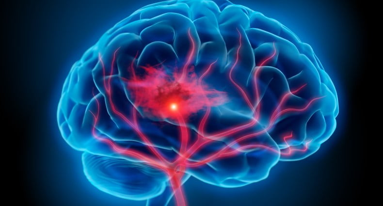 Cientistas impulsionam memória humana com implante cerebral