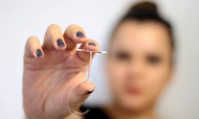 Uso do DIU reduz em um terço os riscos de câncer cervical, diz estudo!
