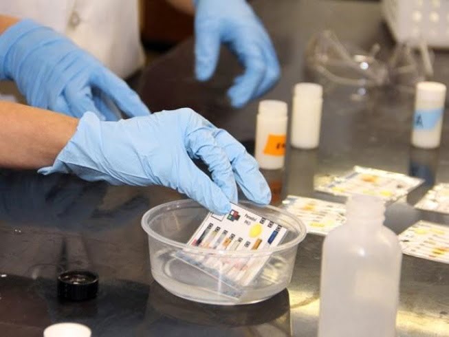 Laboratório japonês testará detecção de câncer com mostras de urina!