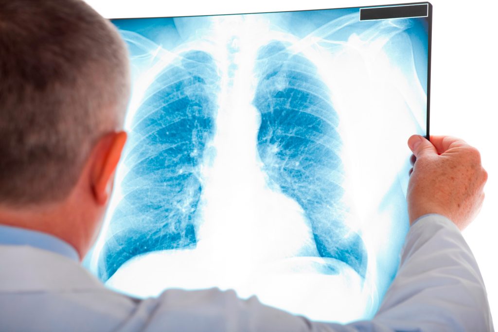 Como diagnosticar e conduzir casos de ASMA?