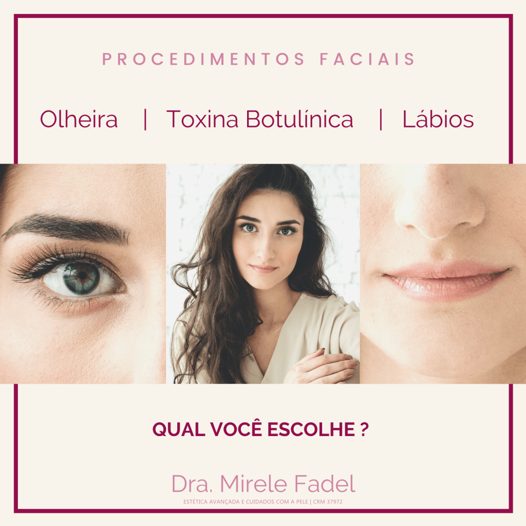 A TOXINA BOTULÍNICA, o famoso “BOTOX” é um dos procedimentos mais buscados pelos pacientes dentro da ESTÉTICA AVANÇADA DA FACE.