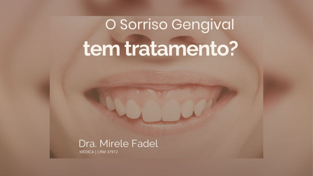 O Sorriso Gengival tem tratamento?