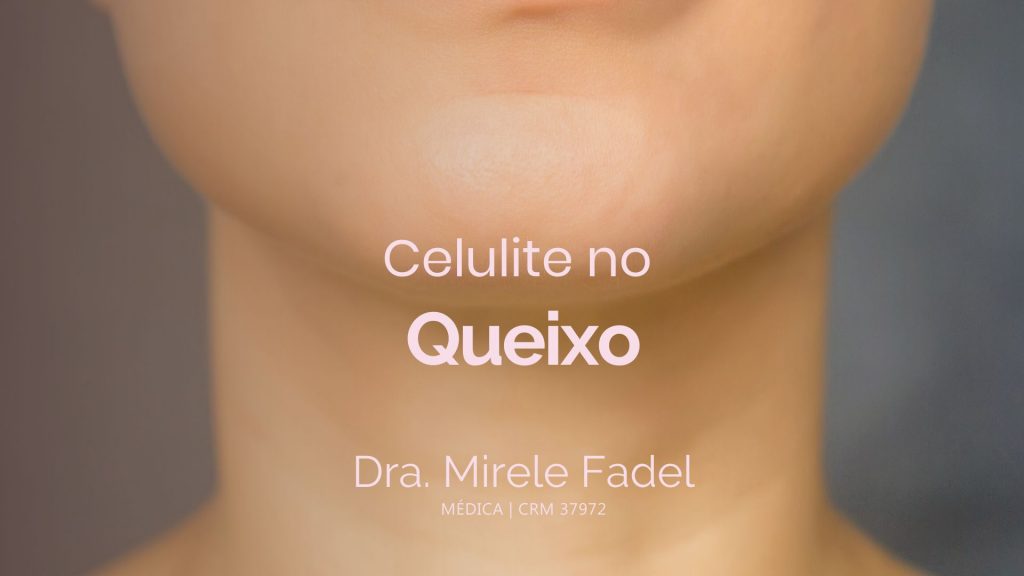 Já ouviu falar sobre o Queixo Celulítico?