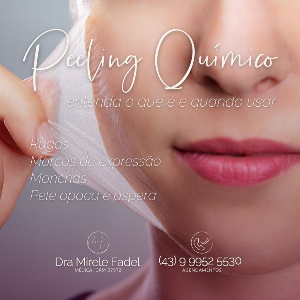 Peeling Químico: Entenda o que é e quando usar.