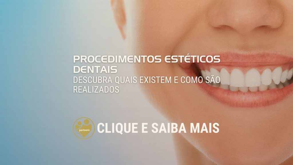 Procedimentos estéticos dentais: Descubra quais existem e como são realizados