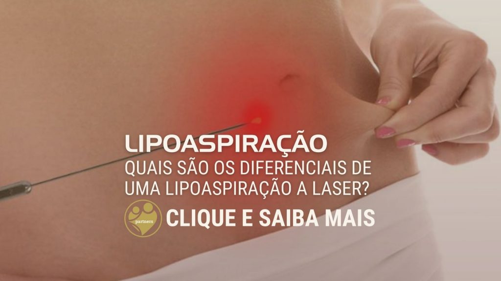 Quais são os diferenciais de uma lipoaspiração a laser?
