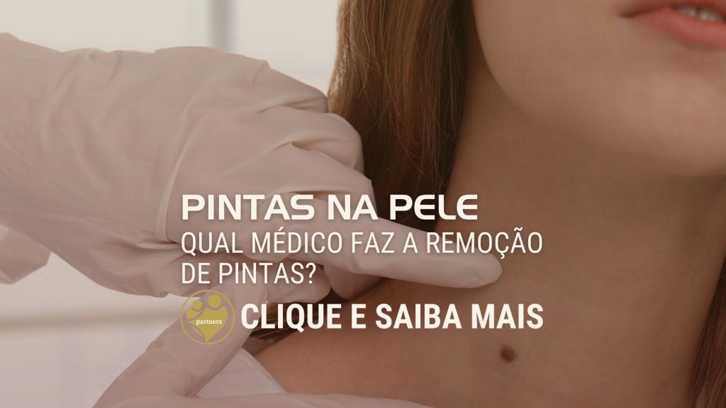 Qual médico faz a remoção de pintas?