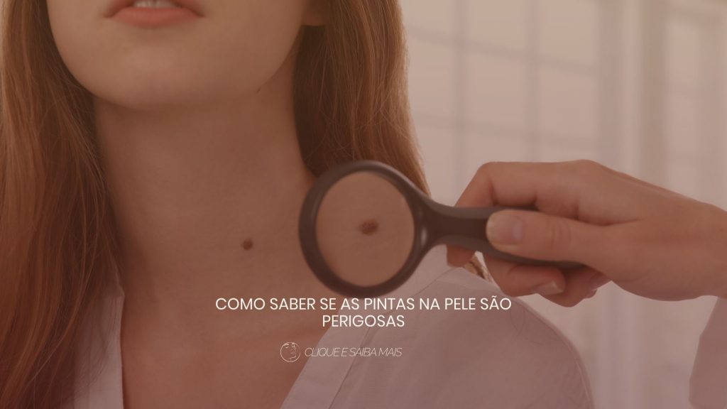 Como saber se as pintas na pele são perigosas