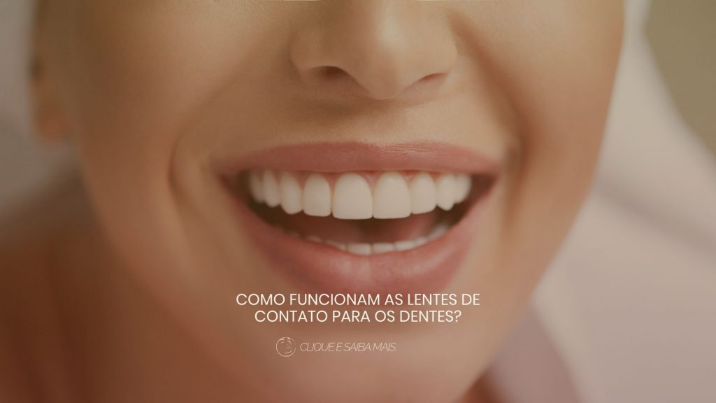 Como funcionam as lentes de contato para os dentes?
