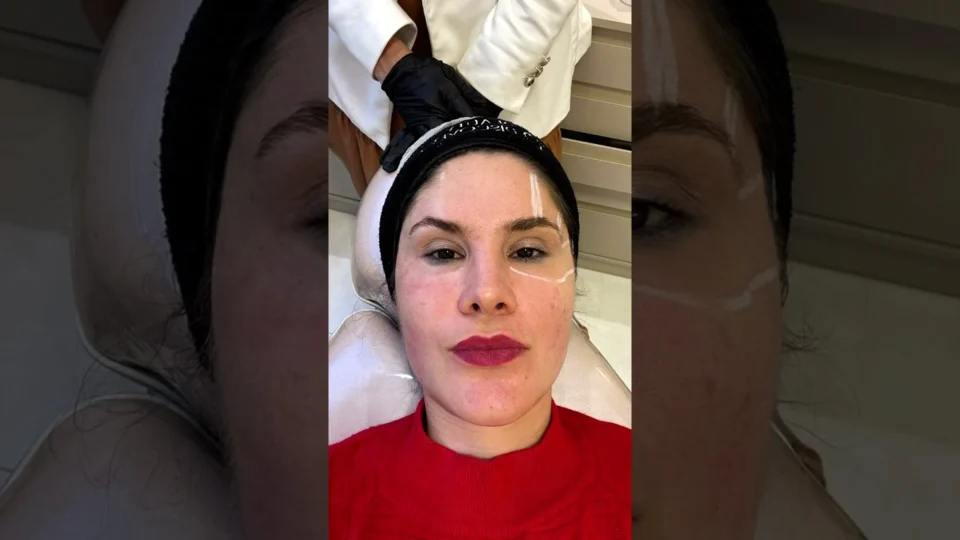 Vídeo: Adeus Flacidez e Rugas: Conheça o Ultraformer MPT