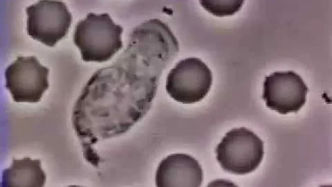 Vídeo: Perseguição implacável: Glóbulo branco captura bactéria